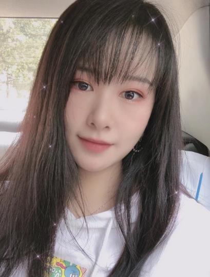 南方醫(yī)院整形美容科顴骨內(nèi)推一個(gè)月