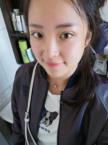 濟南韓式整形雙眼皮術(shù)后二十天 濟南韓式整形雙眼皮術(shù)后二十天