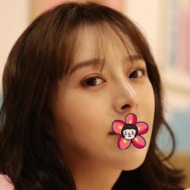 北京基礎(chǔ)美下頜角整形案例效果分享，黃大勇果然名不虛傳