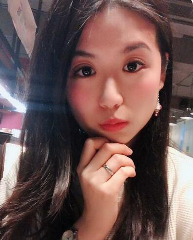 汕頭曙光整形皮秒激光祛斑一個(gè)月效果反饋，斑沒了