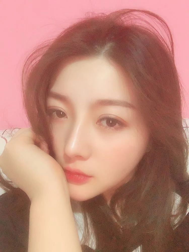 北京圣嘉榮二次鼻修復術后兩個月