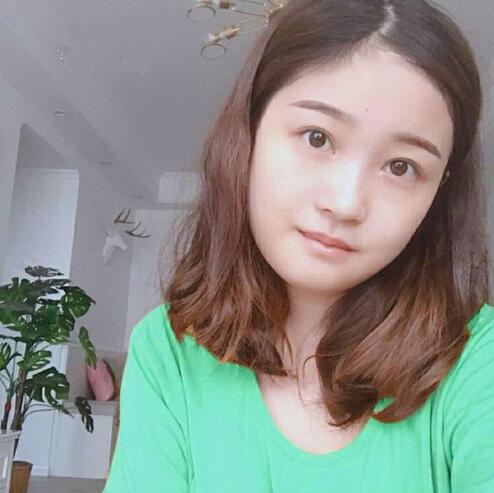 重慶美聯(lián)臣下頜角整形一個月效果 重慶美聯(lián)臣下頜角整形一個月效果