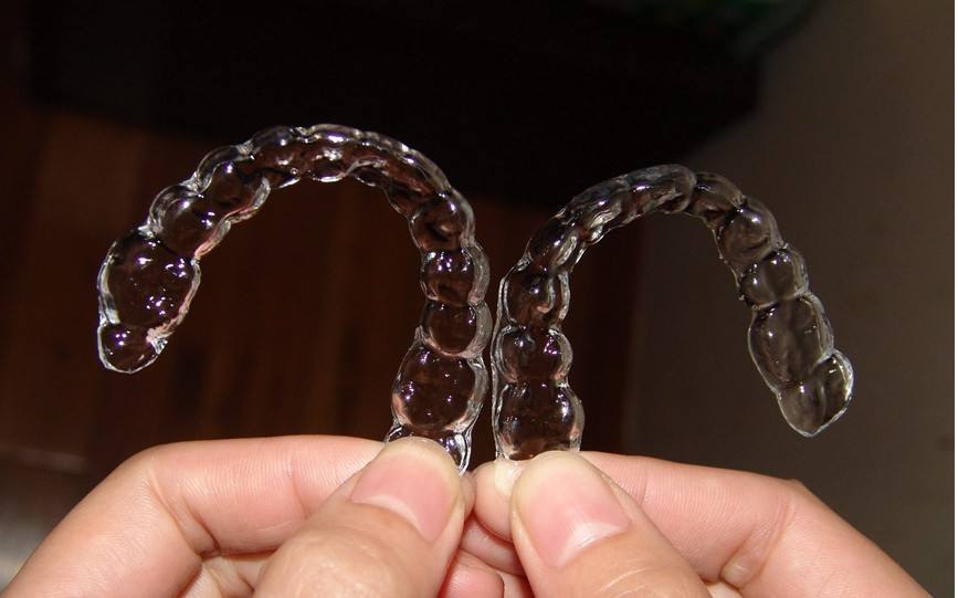 自貢華醫(yī)整形金屬托槽矯正結(jié)束，佩戴保持器