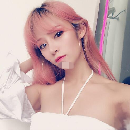 北京崔相平整形雙眼皮修復(fù)案例分享