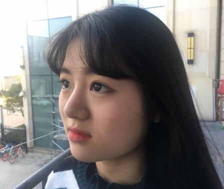 西安希美得整形瘦臉針瘦臉前 西安希美得整形瘦臉針瘦臉前