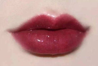 北京海醫(yī)悅美豐唇