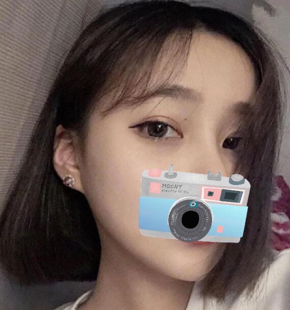 重慶華美整形下頜角整形術(shù)后一個多月效果 重慶華美整形下頜角整形術(shù)后一個多月效果