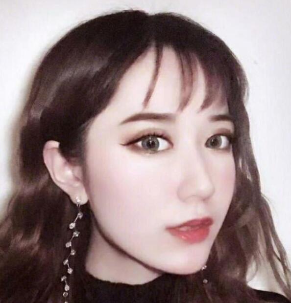 上海藝星整形崔海天下頜角整形術(shù)后三個(gè)月效果