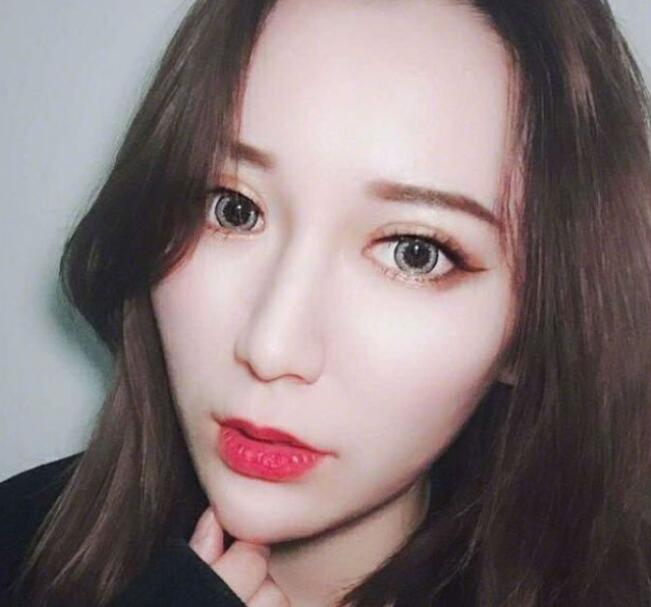 上海藝星整形崔海天下頜角整形術(shù)后兩個(gè)月效果