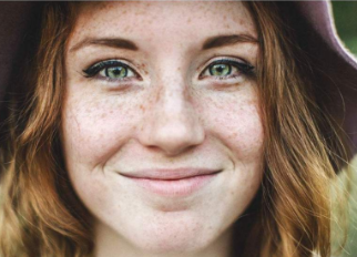 常州澳瑪星光醫(yī)療激光祛斑