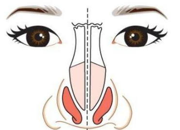 成都百齡醫(yī)療美容鼻矯正