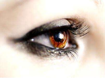 福州愛爾美整形美容醫(yī)院雙眼皮術(shù)后效果