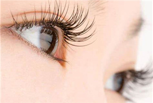 杭州靜港醫(yī)療美容診所開眼角術(shù)后效果