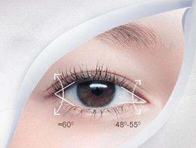 哈爾濱三精女子專(zhuān)科整形開(kāi)眼角術(shù)后效果
