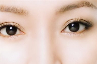 貴陽泰康樂醫(yī)院整形美容科雙眼皮手術后的效果