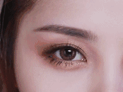 杭州格萊美整形醫(yī)療美容整形醫(yī)院開眼角術后效果