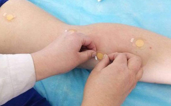 埋線(xiàn)減肥封穴起到什么作用?