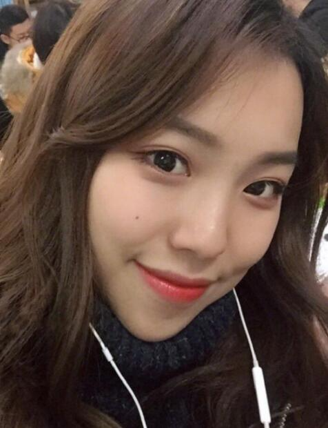 江西省人民醫(yī)院整形外科熊清華下頜角截骨手術(shù)案例分享