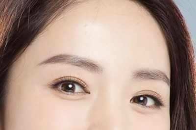 臨沂微整美容醫(yī)院開眼角手術(shù)
