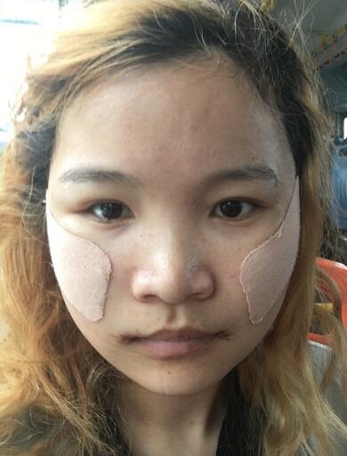 3-200325002411G1.jpg 3-200325002411G1.jpg