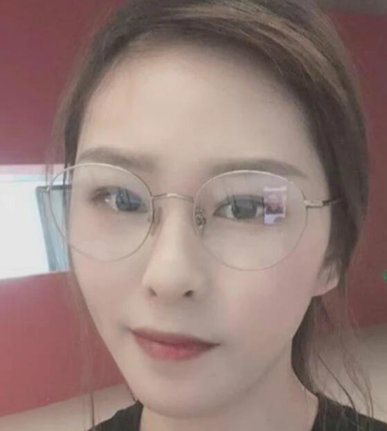 濟南海峽整形醫(yī)院陳娜醫(yī)生激光祛斑恢復效果 濟南海峽整形醫(yī)院陳娜醫(yī)生激光祛斑恢復效果