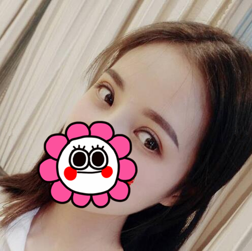 雙眼皮手術(shù)恢復(fù)過(guò)程中