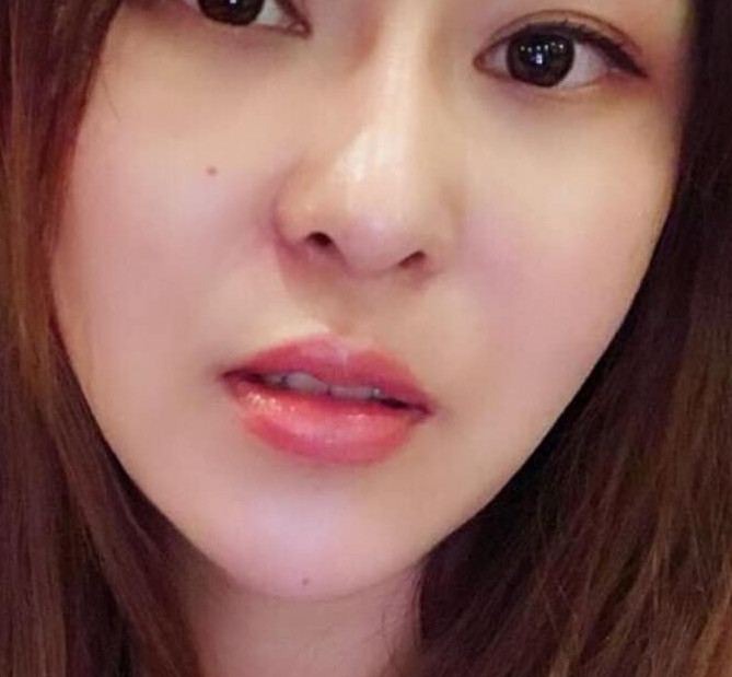 來到鄭州優(yōu)恩醫(yī)療美容醫(yī)院