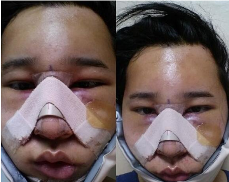 3-20032511020N45.jpg 3-20032511020N45.jpg