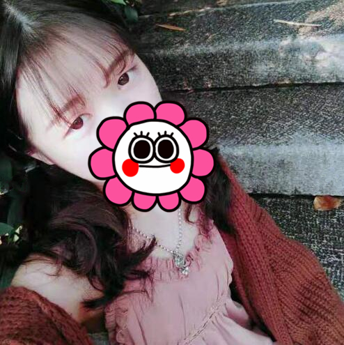 三亞維多利亞整形葉濤醫(yī)生切開雙眼皮案例效果對(duì)比圖