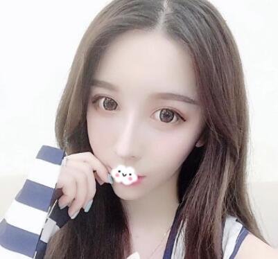 假體隆鼻修復效果 假體隆鼻修復效果