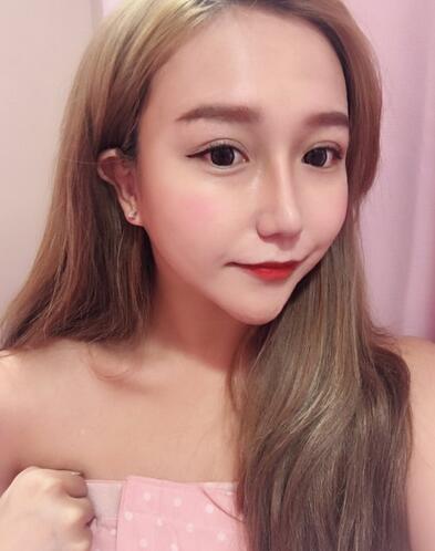 上海藝星醫(yī)療美容醫(yī)院整形醫(yī)生宗建華激光脫毛案例 上海藝星醫(yī)療美容醫(yī)院整形醫(yī)生宗建華激光脫毛案例