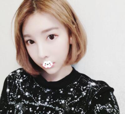 假體隆鼻修復效果 假體隆鼻修復效果