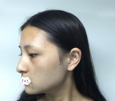 術(shù)前 術(shù)前