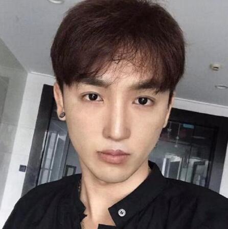 下頜角磨骨手術之后 下頜角磨骨手術之后