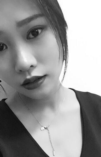 師麗麗雙眼皮案例分享