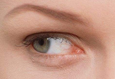 深圳芝華醫(yī)療美容門診部激光祛眼袋