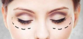 上海時(shí)光整形外科醫(yī)院激光祛眼袋