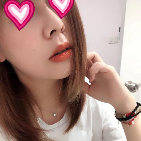 西安儷人醫(yī)院整形醫(yī)生蘇鵬做隆鼻技術(shù)怎么樣？附蘇鵬醫(yī)生隆鼻案例