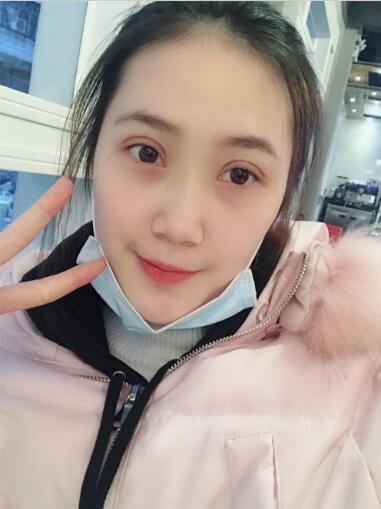 手術(shù)兩周后 手術(shù)兩周后