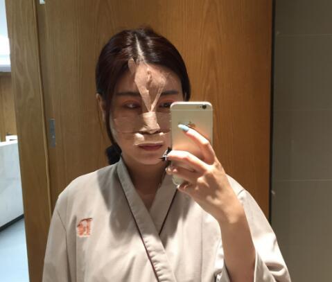 鼻綜合整形手術(shù)時(shí) 鼻綜合整形手術(shù)時(shí)