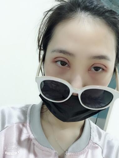 手術(shù)之后 手術(shù)之后