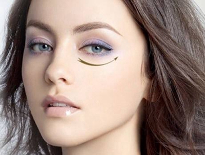 石家莊美然醫(yī)療美容門(mén)診部吸脂祛眼袋