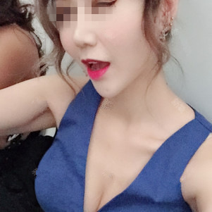 自體脂肪隆胸手術第七天