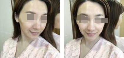 恢復(fù)過程 恢復(fù)過程