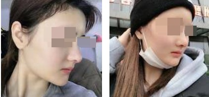 恢復(fù)過程 恢復(fù)過程