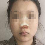 恢復(fù)過程 恢復(fù)過程