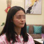 術(shù)前照片 術(shù)前照片