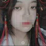 上海亞太醫(yī)療專家周聰做雙眼皮怎么樣？附周聰醫(yī)生雙眼皮案例