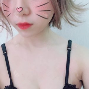 孫軼峰做假體隆胸案例效果對(duì)比圖 孫軼峰做假體隆胸案例效果對(duì)比圖