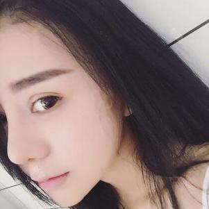 硅膠隆鼻第12天